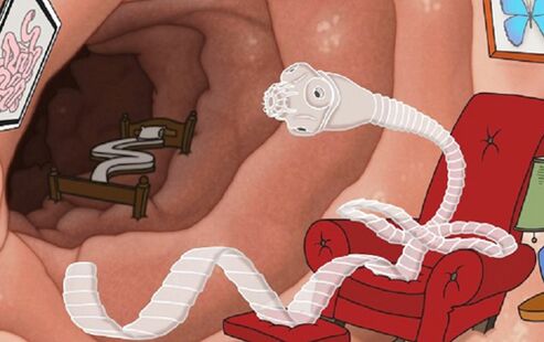 Un parassita nell'intestino si stabilì